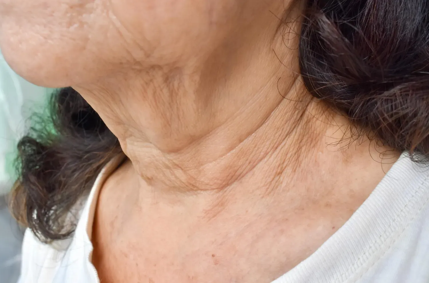 Comment diminuer les rides du cou ?