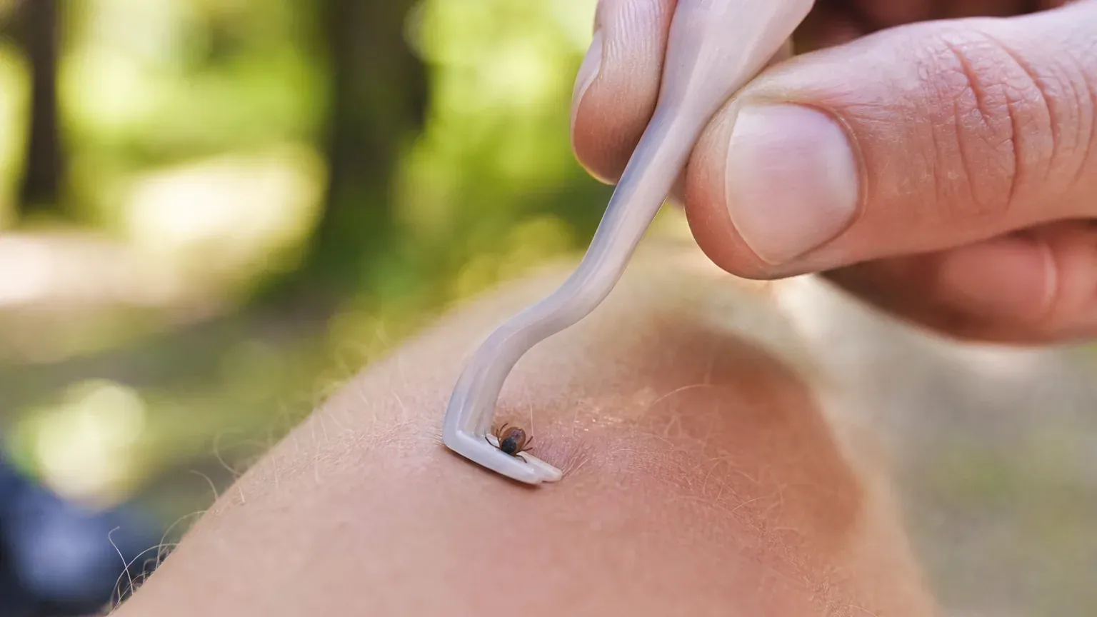 Retrait d'une tique sur la peau à l'aide d'un tire-tique lors d'une sortie nature